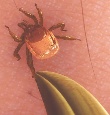 Tick crawling on leg